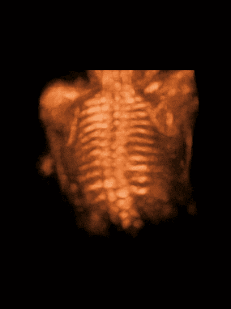 P11Elite – Échographe Stationnaire Polyvalent pour Médecine Générale & Spécialités