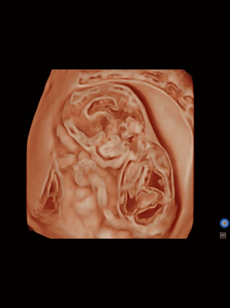 P50 Elite – Échographe Stationnaire Haut de Gamme pour Cardiologie & Gynécologie