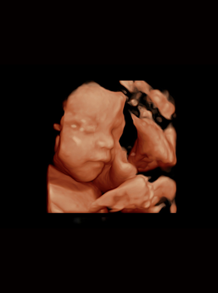 P60Exp – Échographe Stationnaire Expert Radiologie et Cardiologie