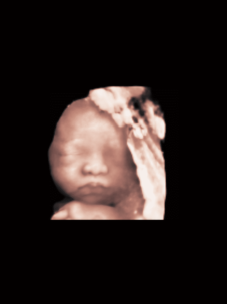 P70i – Échographe Stationnaire Expert Santé Féminine & Périnatal