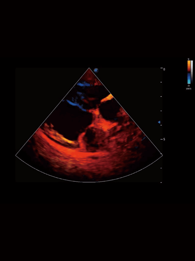 Propet 60 – Échographe Vétérinaire Stationnaire Haut de Gamme