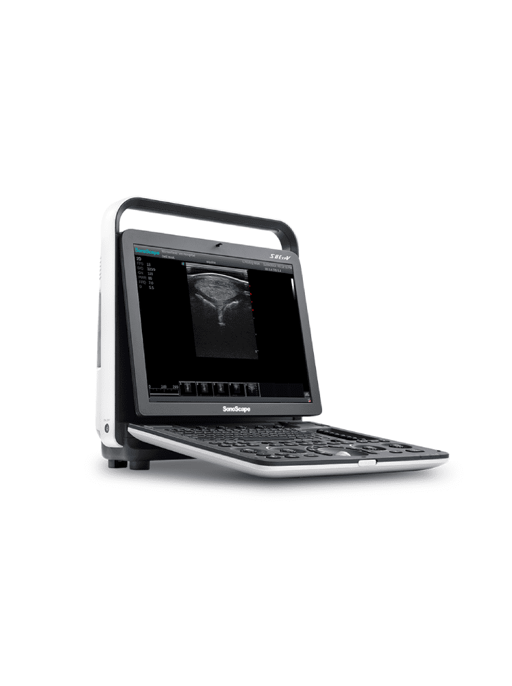 S8 Exp V – Échographe Vétérinaire Portable & Polyvalent